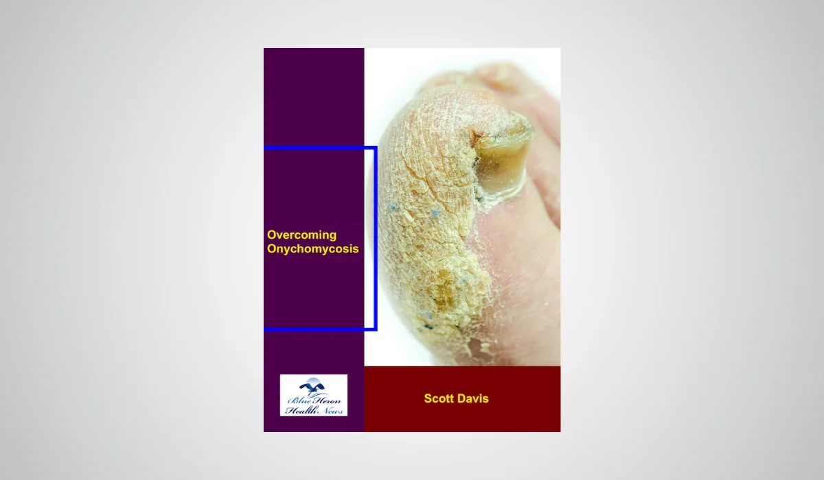 OvercomingOnychomycosis